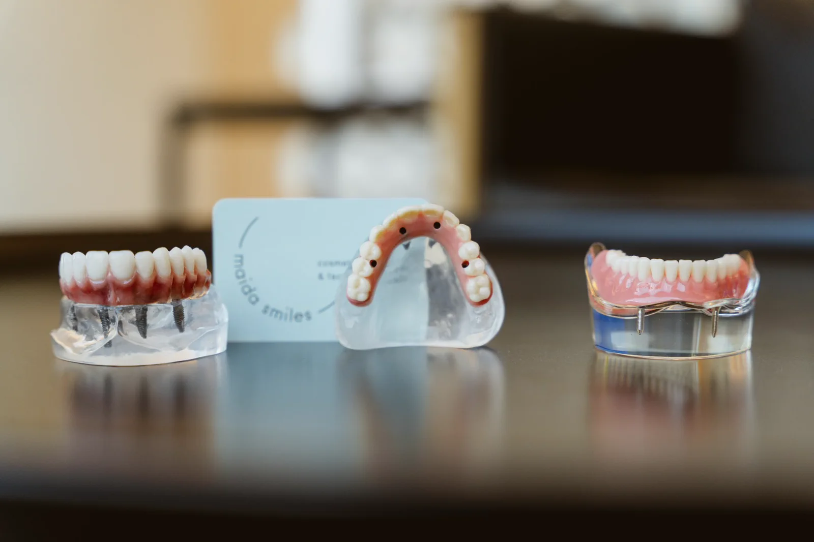 Three implant-supported dental models show different full-arch designs.
